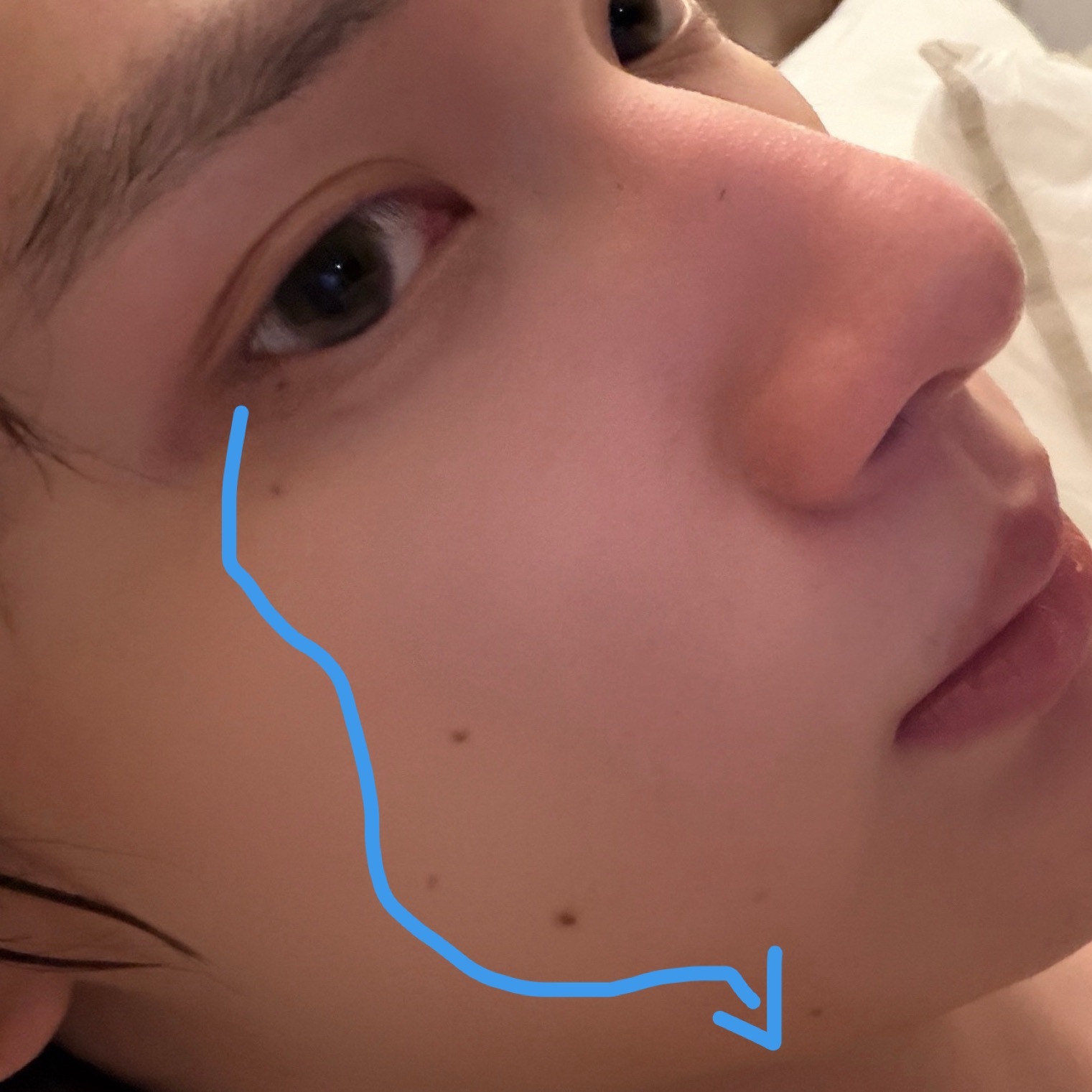 我痣性恋了 ​​​