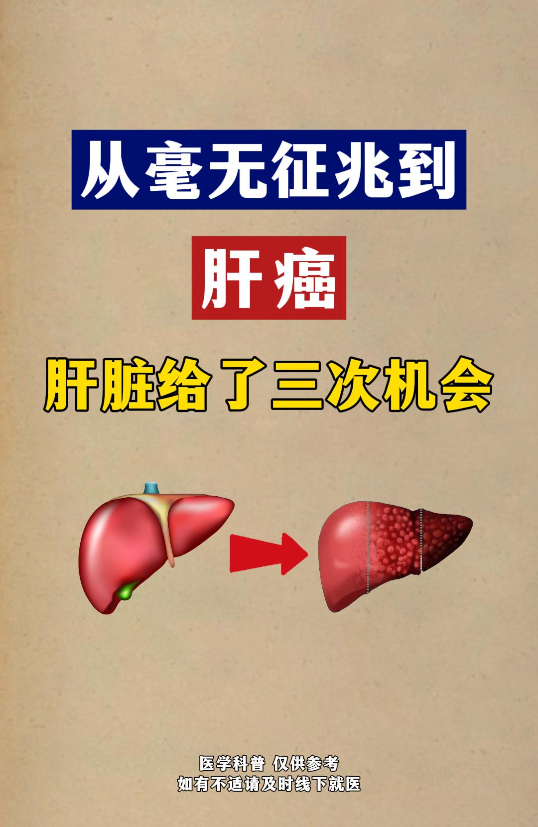 从毫无征兆到肝癌肝脏给了三次机会。