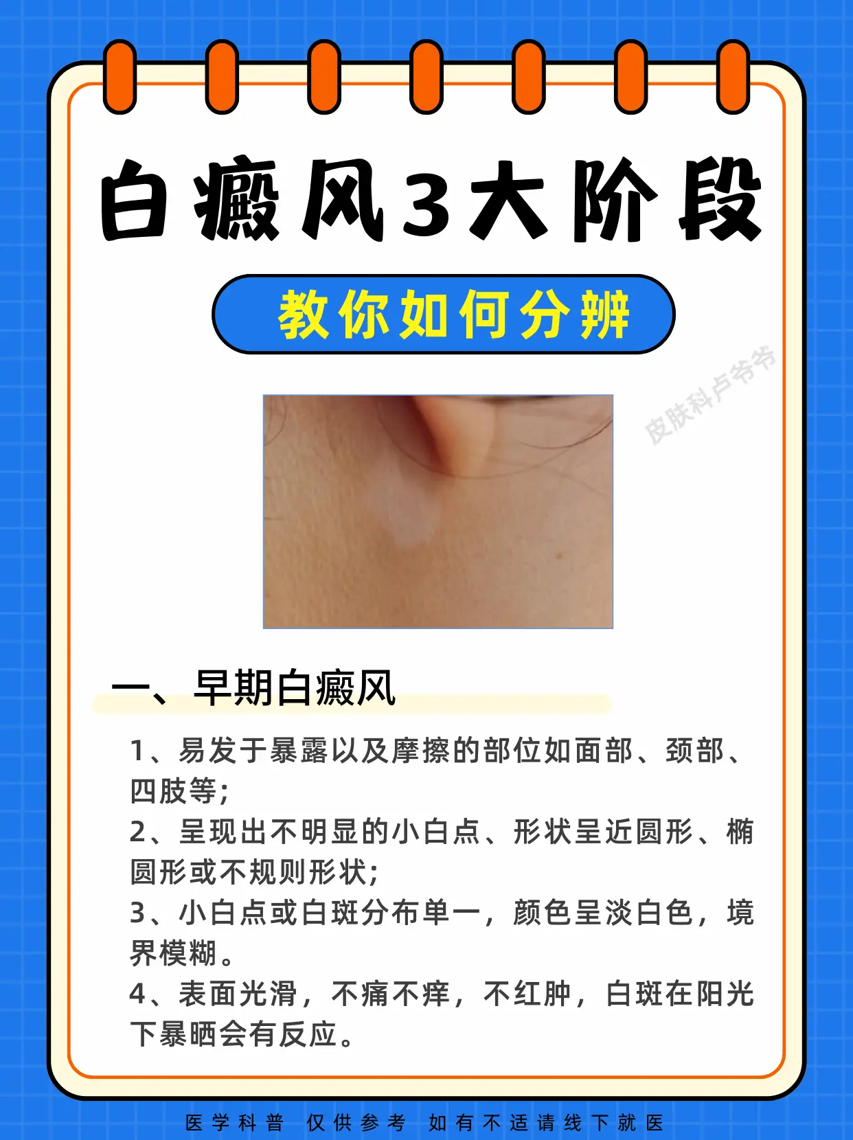 医学科普 白癜风 白斑 硬核健康科普行动  皮肤健康