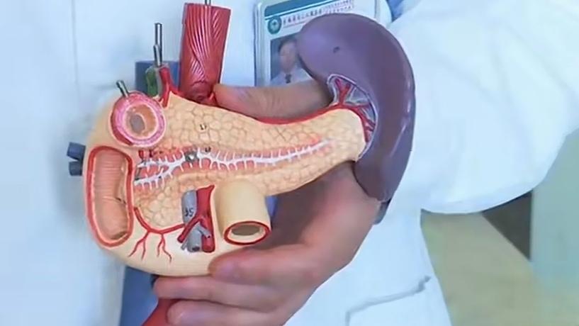 🔥昆明人注意！吃杀猪饭千万别任性，男子频繁赴宴险丧命，这个病太凶险。揪心！昆明