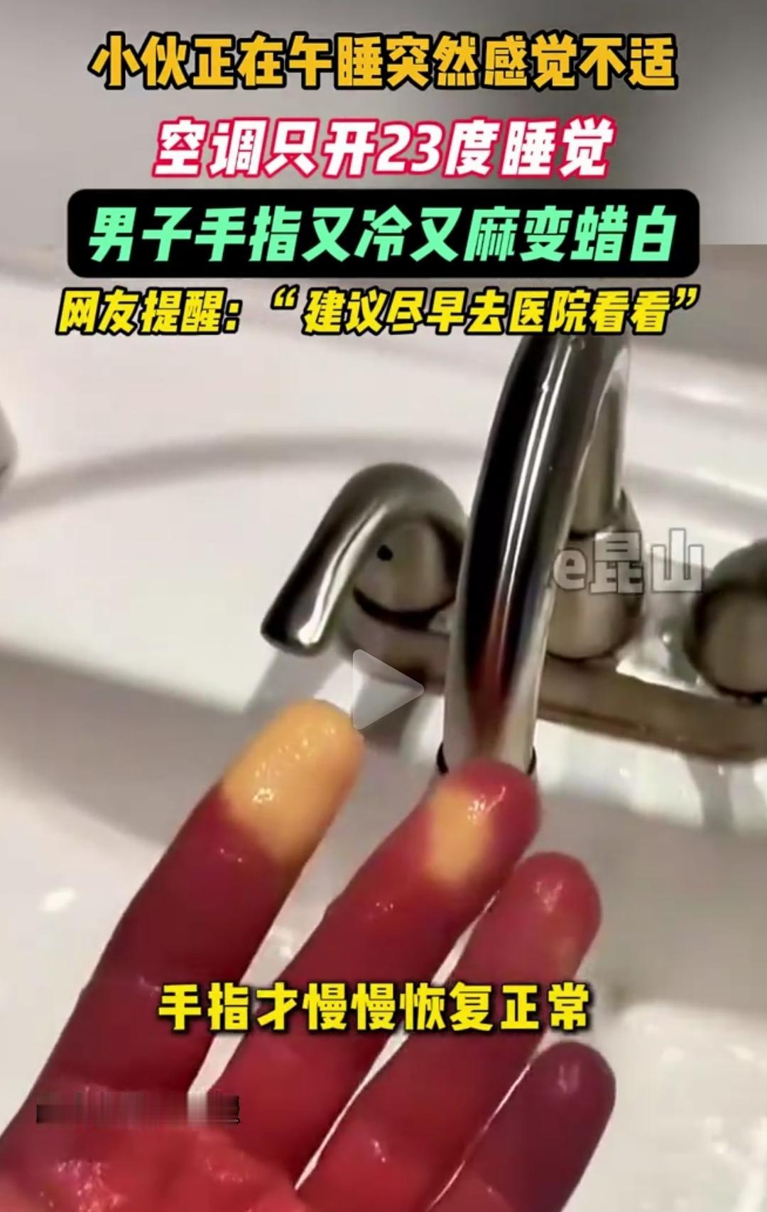 后怕！男子午睡空调直吹双手，醒来手指惨白麻木差点冻伤
 
高温天很多人午睡离不开