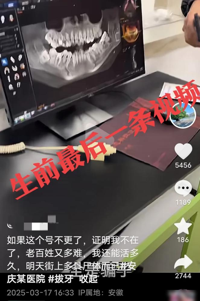 看到这条新闻真的揪心！34岁的李女士在安庆市立医院拔智齿，结果医生误拔好牙后用铁