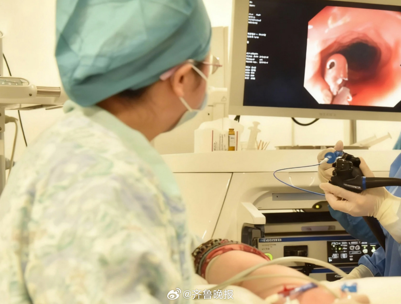 【#这几类人建议尽快做一次胃镜#】根据《胃癌早诊早治中国专家共识（2023版）》