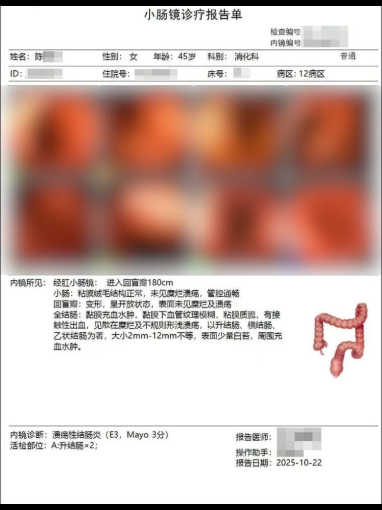 溃疡性结肠炎：从反复糜烂到临床缓解，我用临床经验告诉你怎么稳住状态  ...