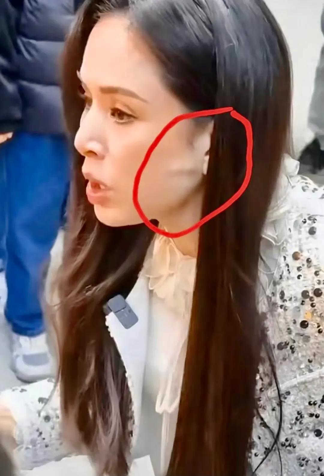 “小龙女”李若彤脸上这个骨头是怎么了？
今年是龙年，莫非“小龙女”要浮显变真龙？