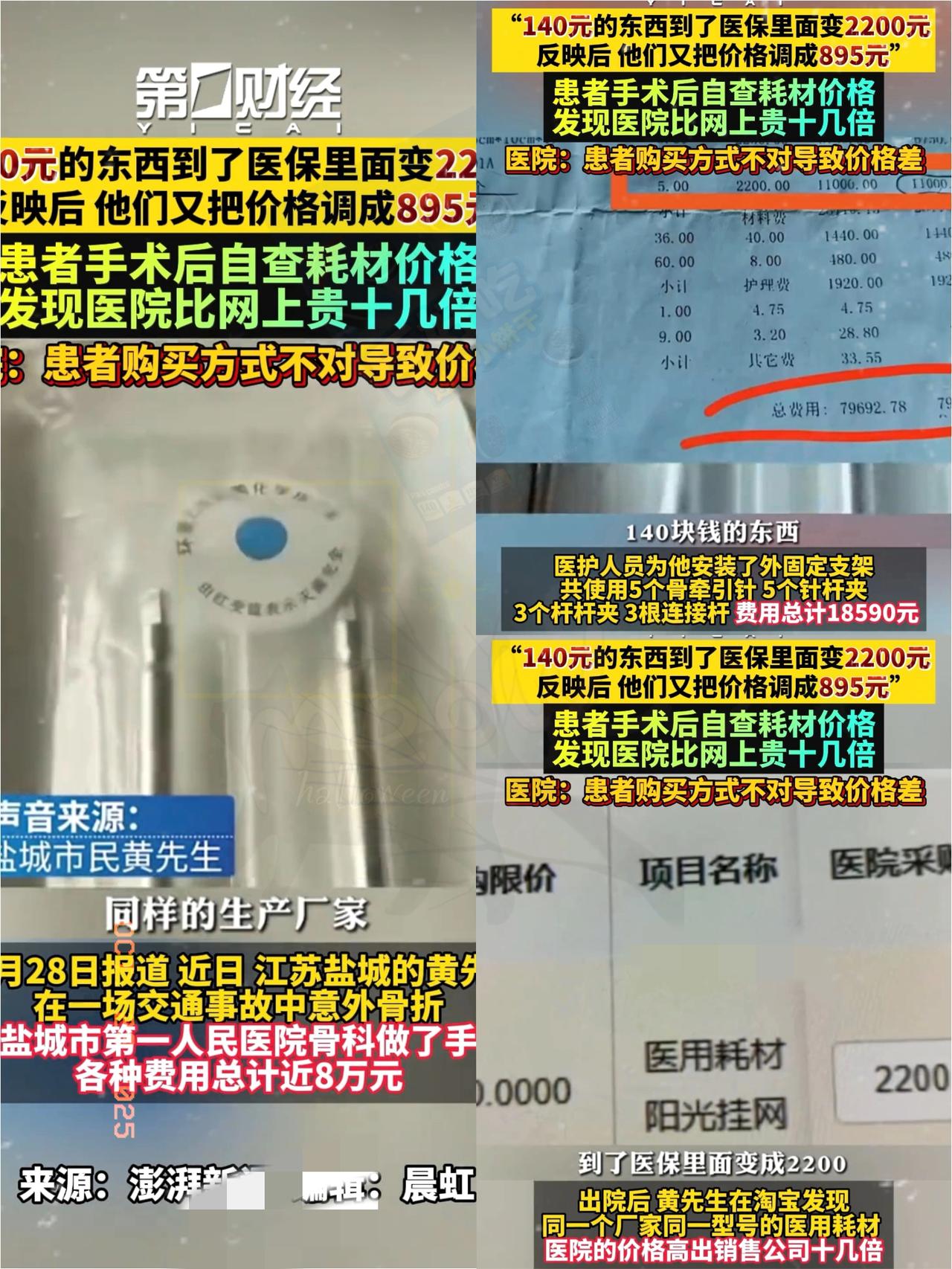 刷医保的糊涂账，这次是真的忍无可忍了！
 
江苏盐城黄先生骨折手术，一个耗材淘宝