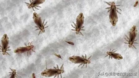 网上有人说起以前普遍长虱子的事，有人就在评论区说：“这是故意抹黑过去，虱子又不是