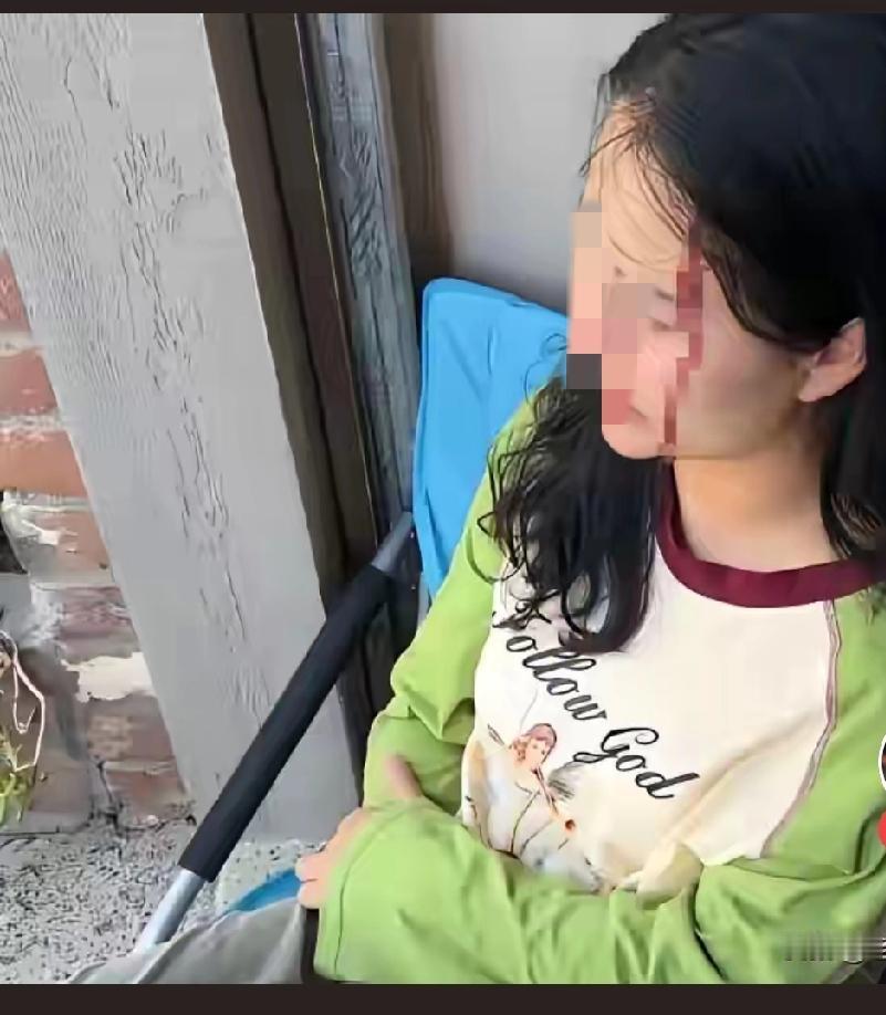 以前她天天夸自己的白人老公，让人误以为她嫁给美国人很幸福
现在被她白人老公打得头