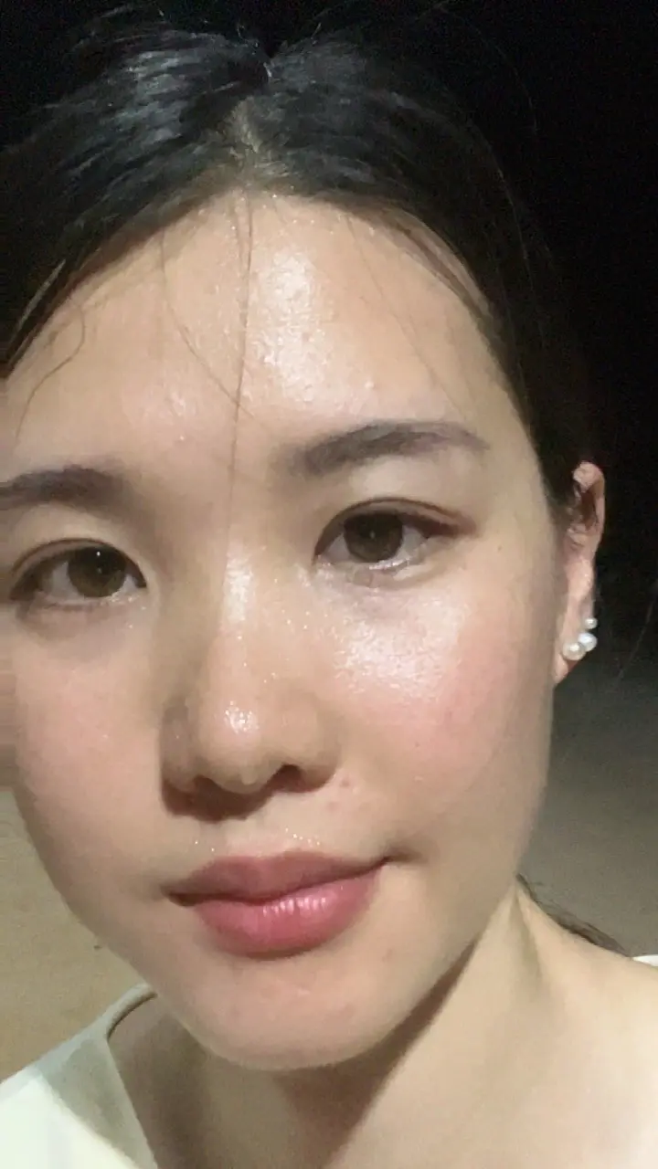 打了几天羽毛球 手痛哦