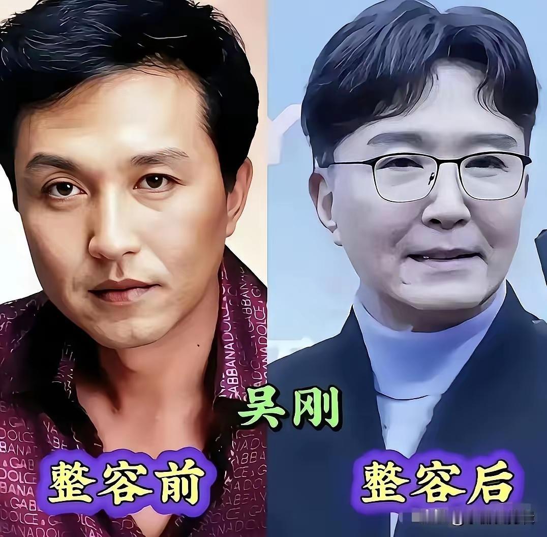 这男演员为啥也都热衷于医美呢？尤其是中年男演员，他们对自己的颜值是不是也有着执念