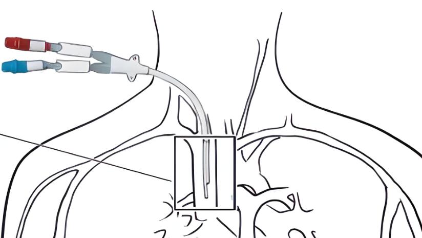 化疗药口服和静脉注射有什么不同？在癌症治疗中如何选择？

“殷主任，同样是化疗，