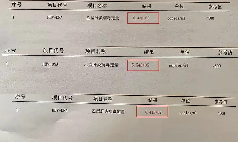 乙肝抗病毒1年以上，降到这个数才安全！ 高病毒复制8次方→中病毒复制5...