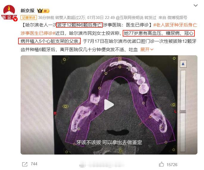老人一次拔牙12颗种6颗后身亡 这是什么草台班子呀[汗][汗][汗]挺无语的就是
