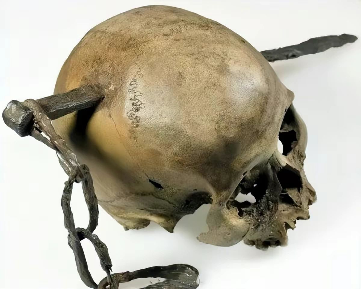 悲惨的奴隶，头骨被刺穿，依然坚持工作….