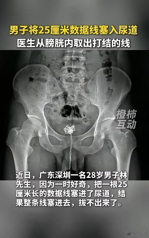 “成年人怎么能干出这种事儿？”6月23日报道，广东深圳，一位28岁的成年男子，竟