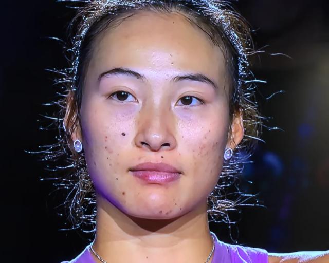 运动排汗不靠谱？我就纳闷了，明明郑钦文运动量那么的大，为何脸上还是那么多的痘痘呢