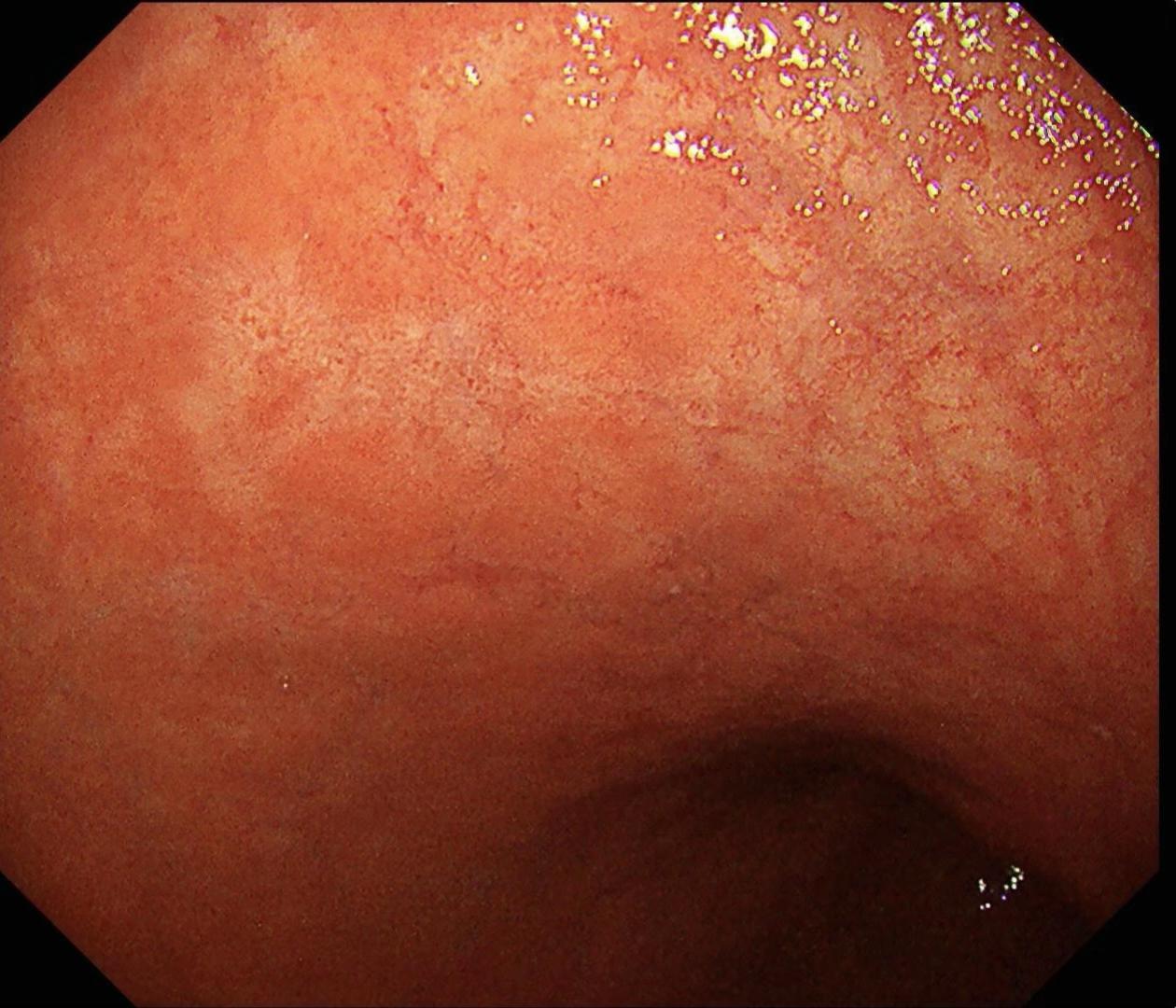 萎缩背景中的褪色调。泾清渭浊，匪恃目明，静验其枢。