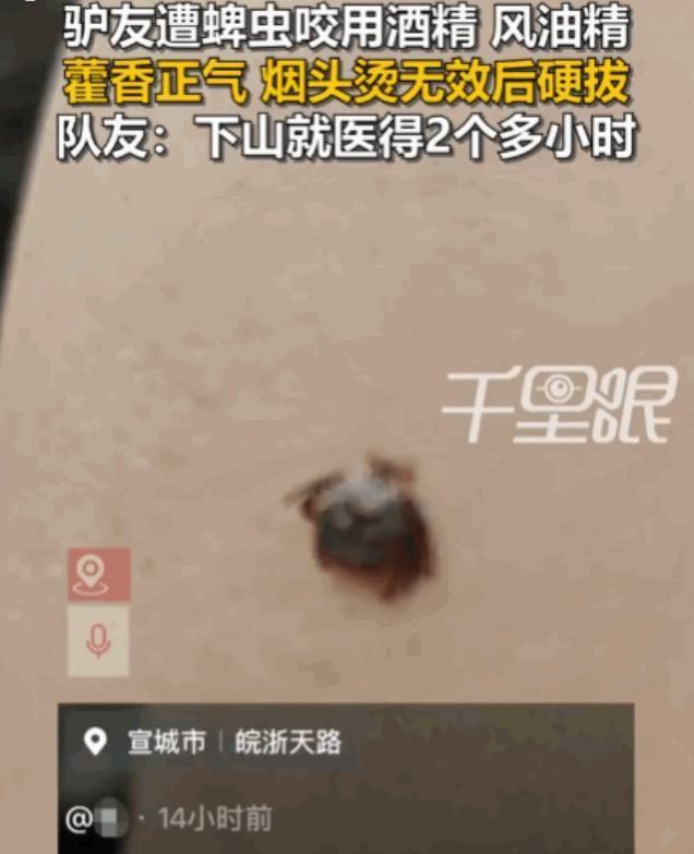 太可怕了！安徽宣城，一男子徒步至半山腰时，不幸被蜱虫紧紧咬住。因下山就医需两小时