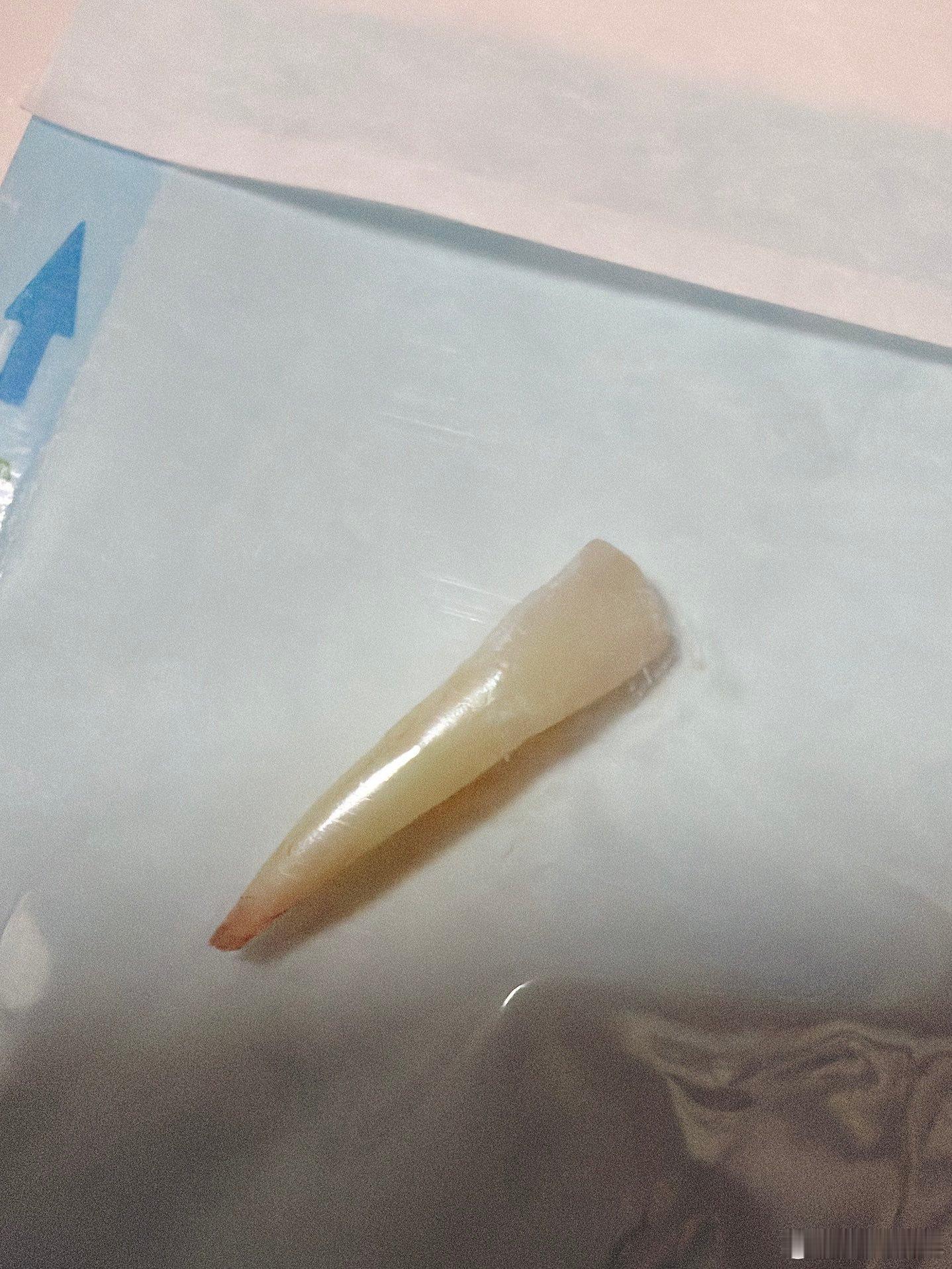 没想到下门牙的牙根居然这么长