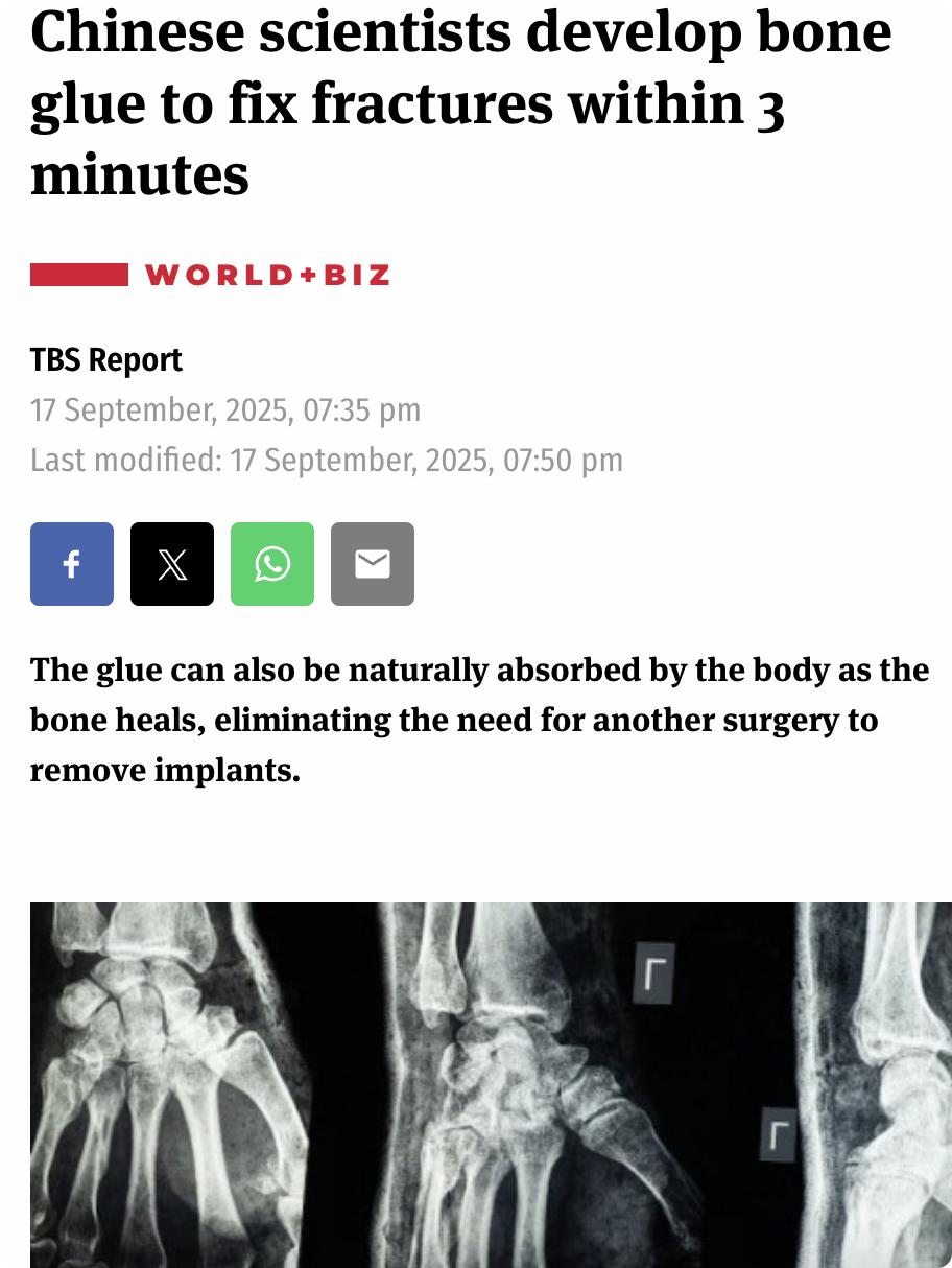 外媒：中国科学家开发出一种名为“Bone-02”的医用骨胶，能在3分钟内修复骨折