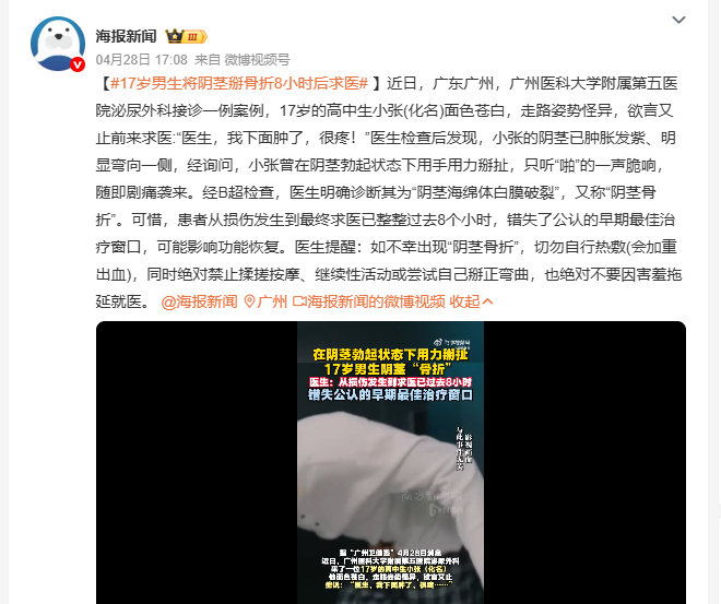 17岁男生将阴茎掰骨折8小时后求医 广州一17岁高中生小张，阴茎勃起时自己掰扯致