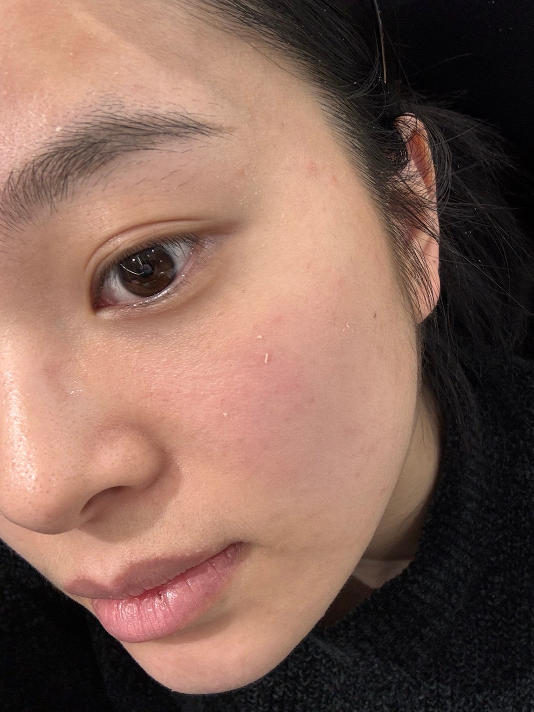 敷脸一个过期面膜就这样了！好干好痒 