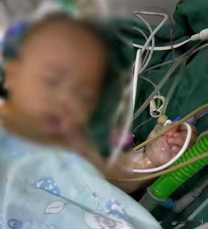 宁波5个月女婴手术期间离世，
看了下诊疗过程，
感觉这事会有反转……
因为2个重