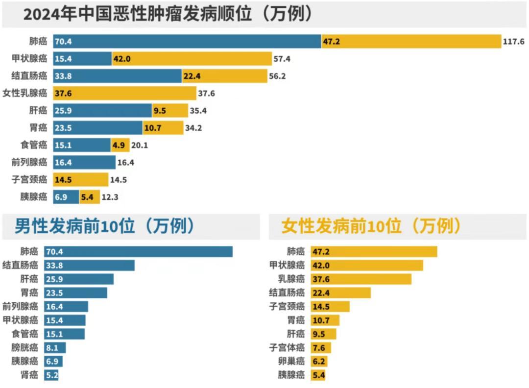 最新癌症排行榜发布，肺癌断崖式位居榜首，三大结节好发部位居前列
国家癌症中心公布