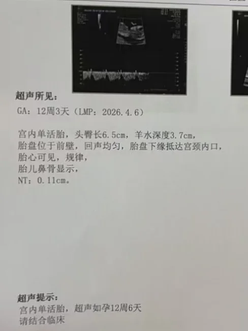 Nt秒过，接顺利