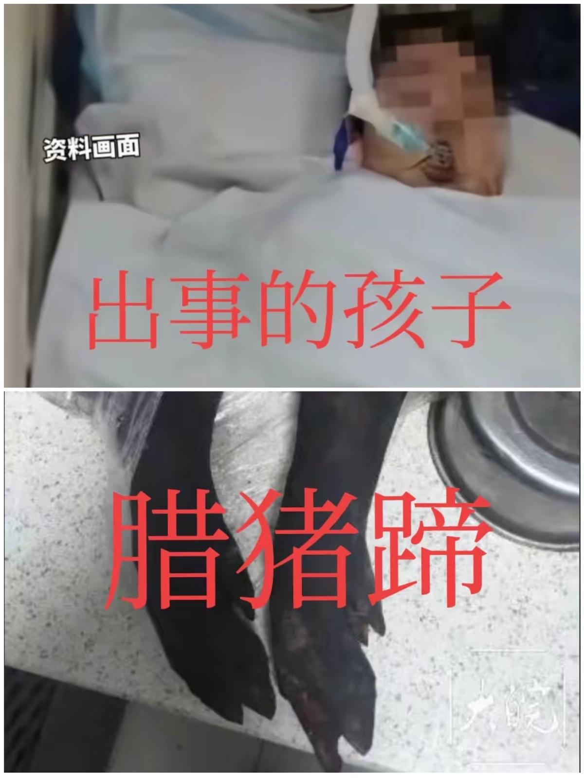 "本可避免。"成都，一名10岁男童在家吃腊猪蹄时卡喉身亡，这场悲剧让所有人痛心，