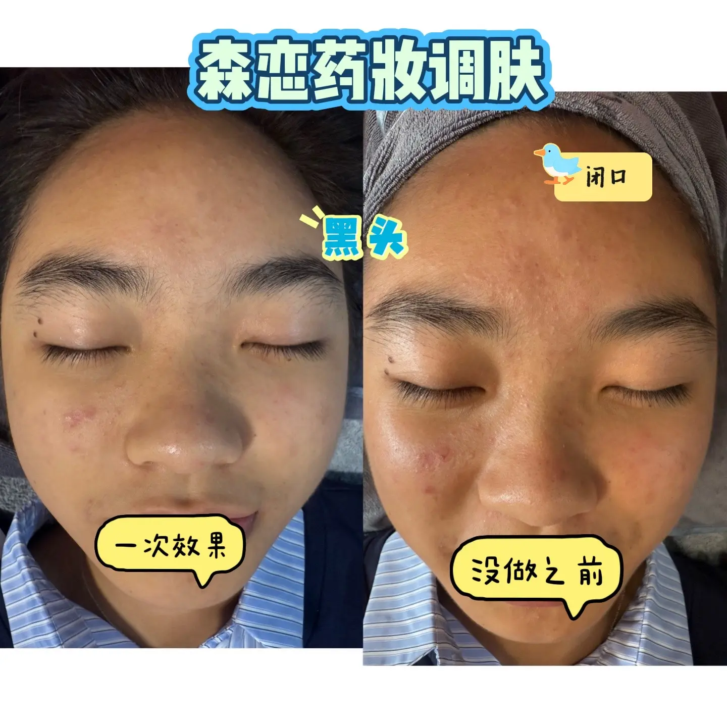 真实护肤案例 改善素颜肌 专业线护肤才是真有效 实体店靠口碑