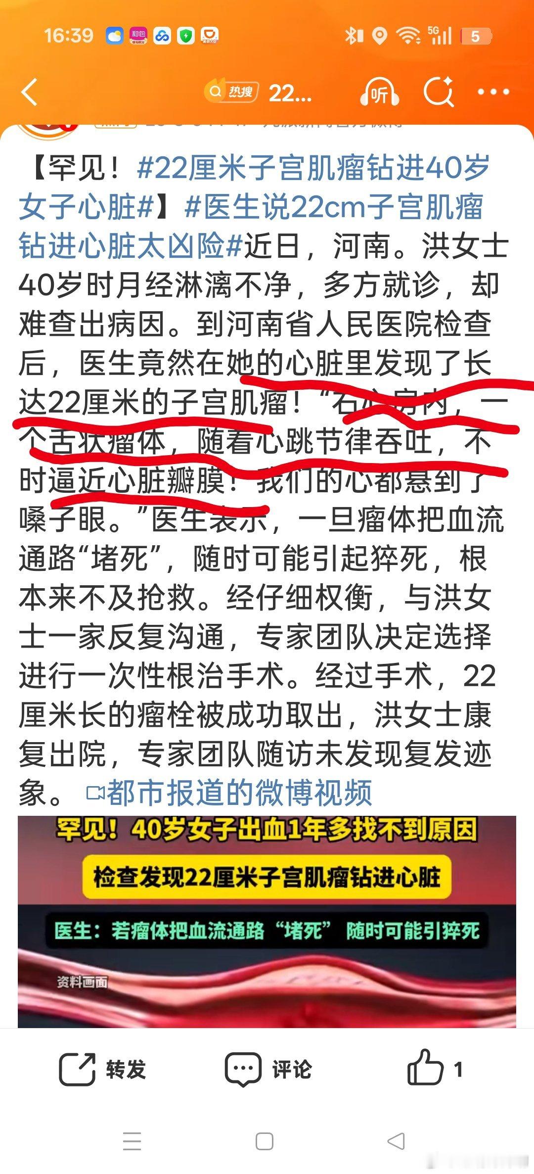 22厘米子宫肌瘤钻进40岁女子心脏 这段文字看的我肚子痛了一下[裂开][裂开][