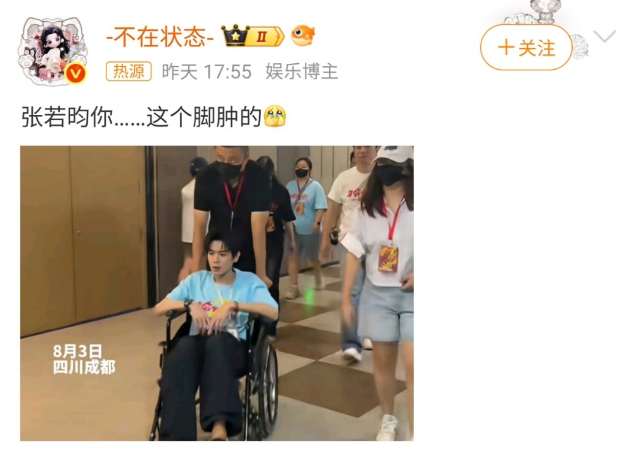 张若昀脚肿了天呐这脚肿得也太让人心疼了吧🥺 哥你这是又拍戏把自己往死里拼了吧？