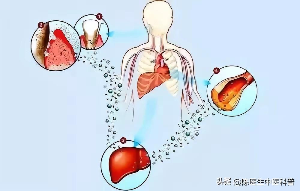 4个“天然抗炎”中成药，不用抗生素，也能消炎症！
 
提示：本内容仅供健康科普，