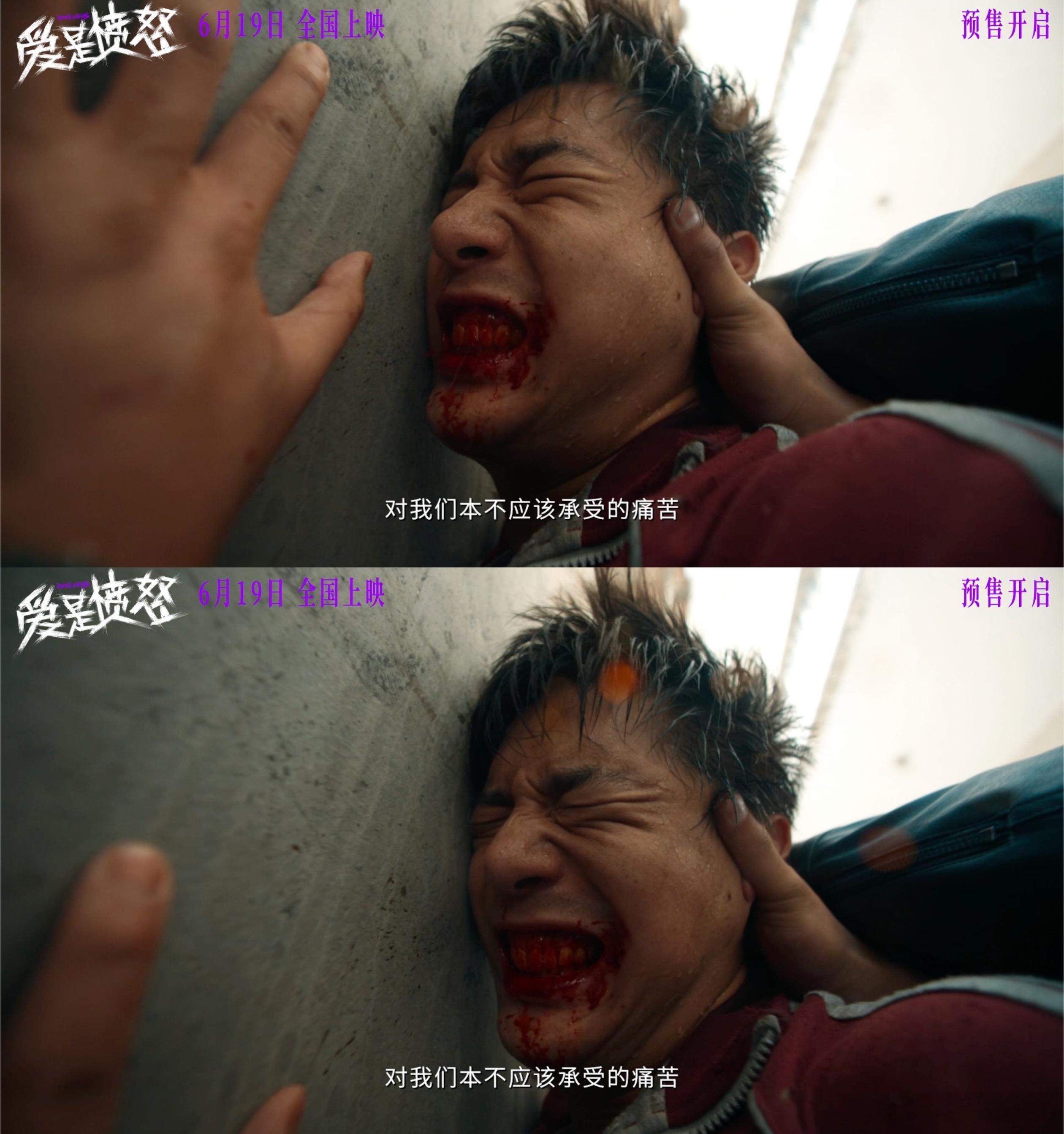 王安宇你牙呢王安宇怎么缺了两颗牙王安宇怎么缺了两颗牙啊哈哈哈！缺牙版更有故事感怎