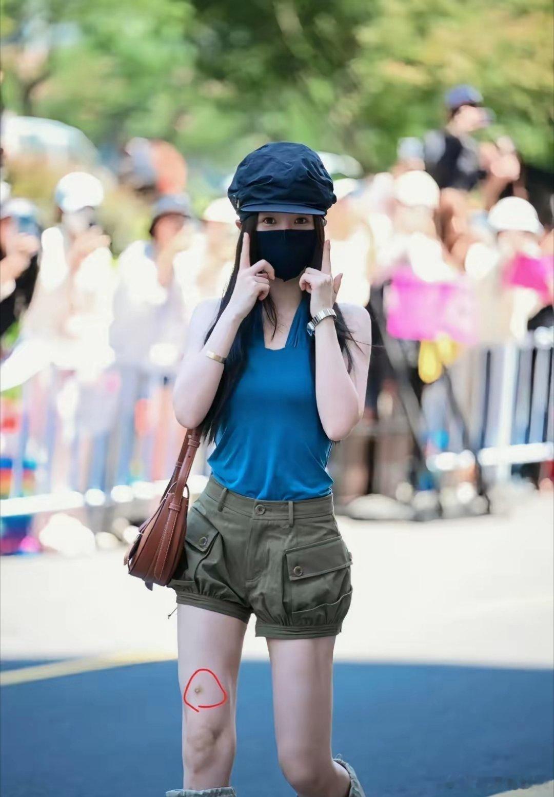 现在女明星都太拼了王楚然脚走路一瘸一拐虞书欣大腿有5厘米淤青，都太敬业了虞书欣拍