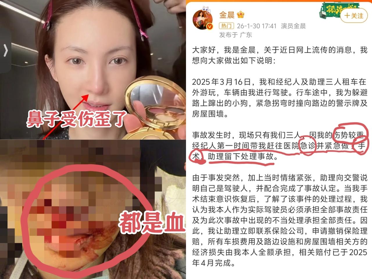 我想过金晨是喝酒了，
也怀疑过金晨鼻子撞歪了，
但没想到当时情况那么紧急，金晨脸