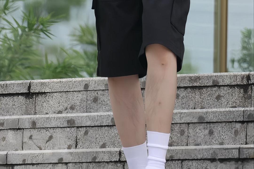 腿毛都是好看的