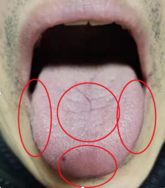 患者咨询，辨舌象，查健康。
患者：52岁
主症状：胃胀，不消化，同时头晕脑胀耳鸣