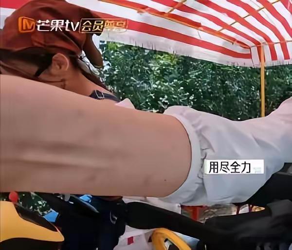 有网友表示：留几手腿上手上好多疤啊🌚大家都说让葛夕去检查身体。 