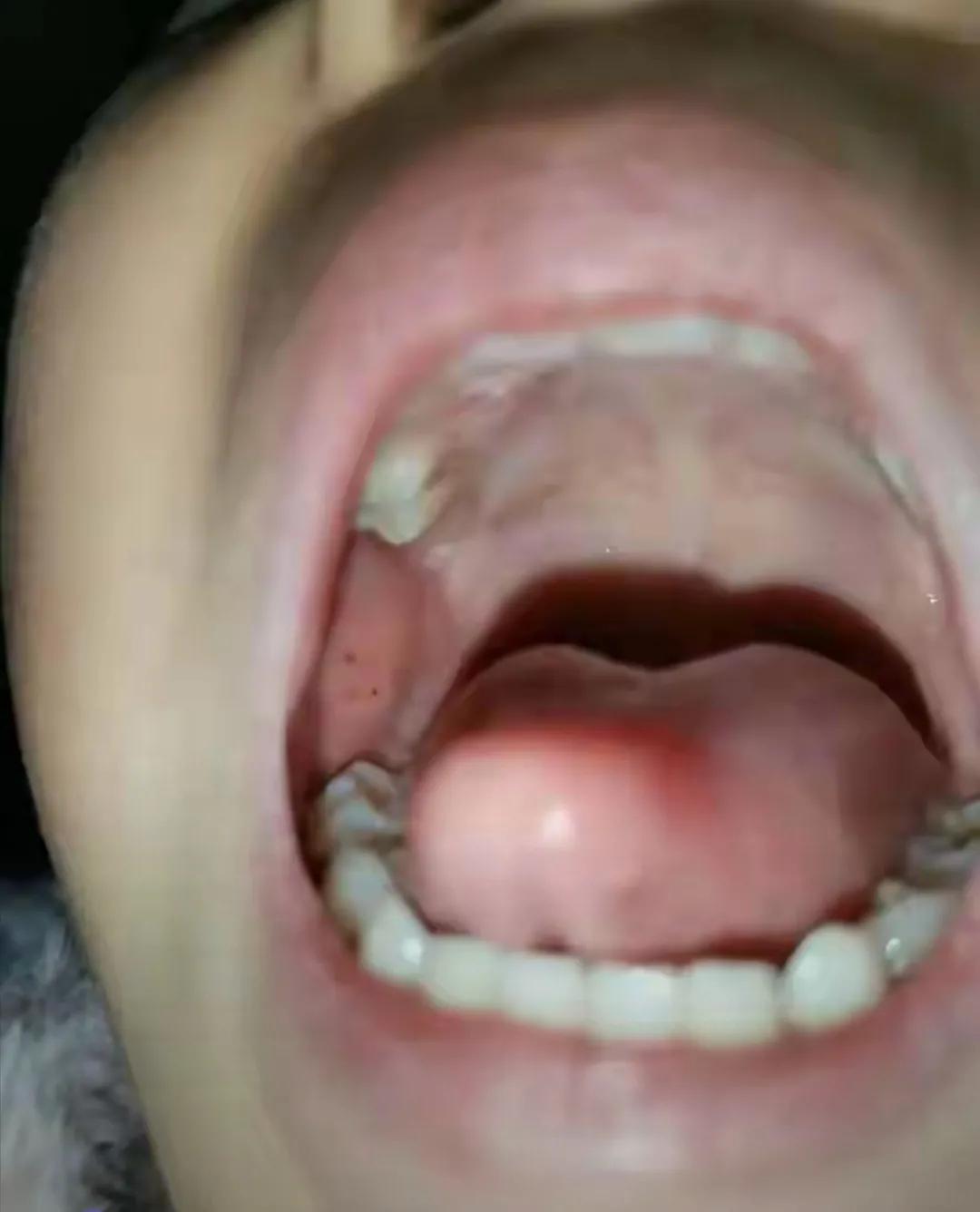 《惊爆！“至少上百处针眼”：3岁女童疑在幼儿园遭虐，真相待查》
 
11月11日