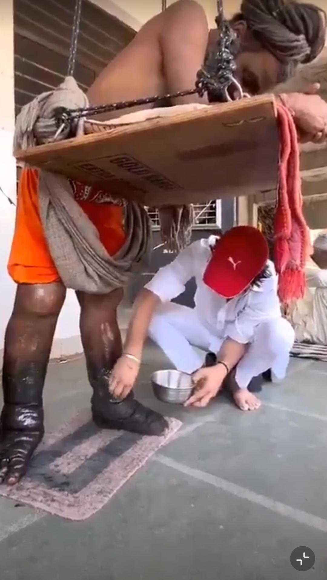 有一点我没闹明白，这哥们就站这不动？
他但凡活动活动腿，也不至于肿成这样吧？
他
