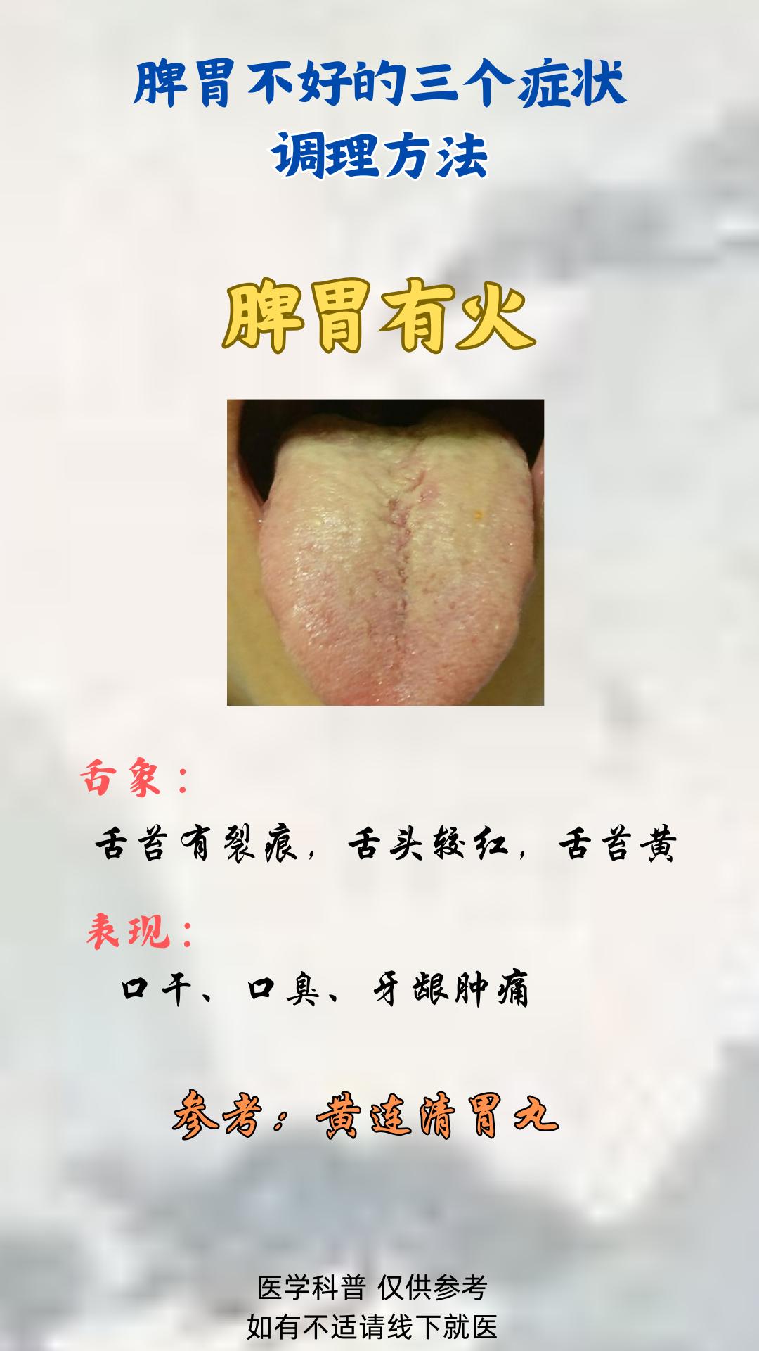 三这脾胃调理的方法，你一定要知道 ！养脾胃[话题]中医养生