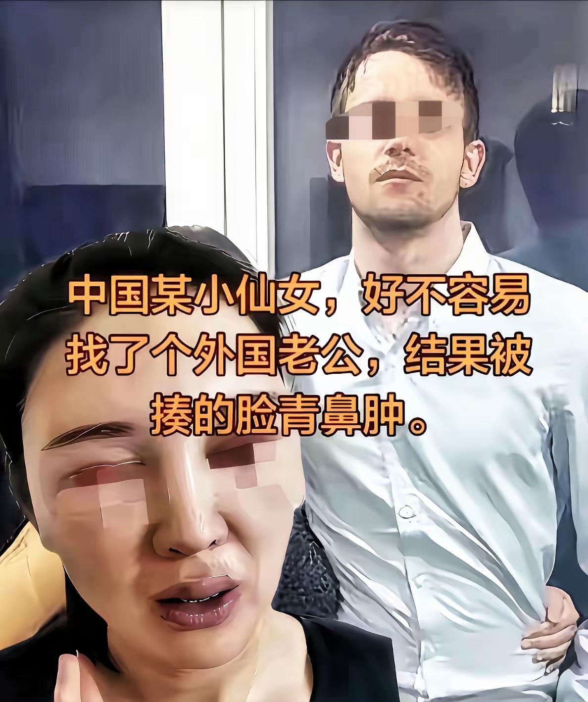 一中国女子嫁了个外国老公，三天两头被家暴，经常是鼻青脸肿。更令人想不到的是，被家