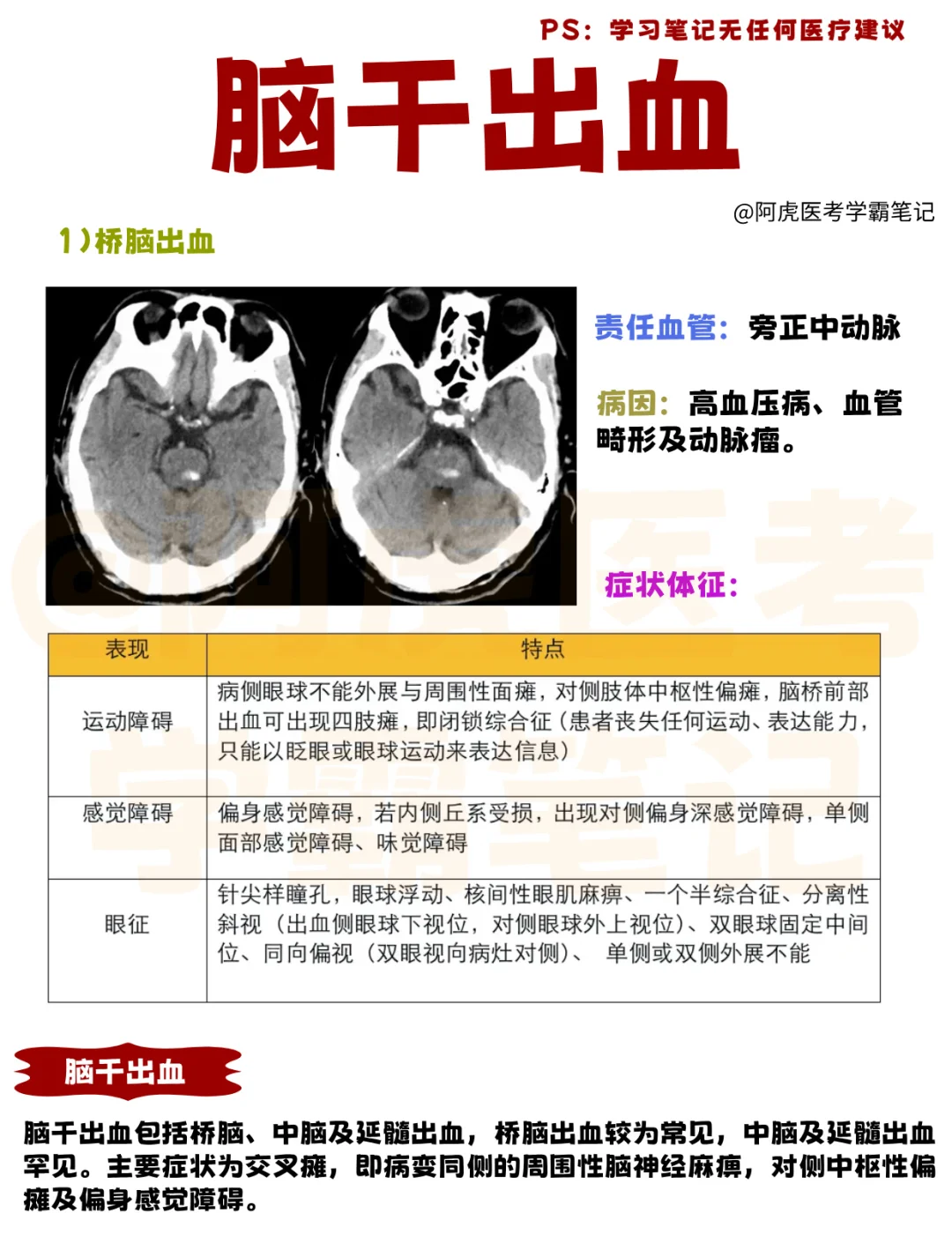 医学生笔记📒｜脑干出血👆