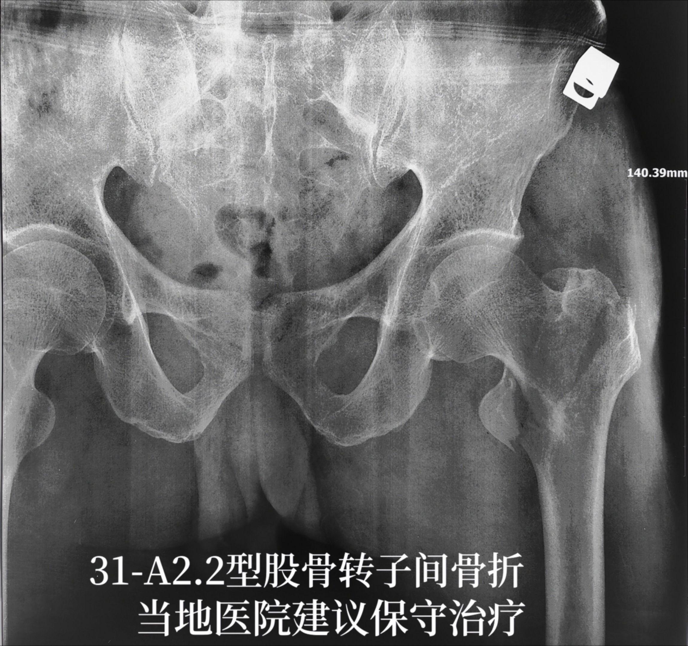 医疗科普的价值就在于尽量缩小医患之间的信息差，让患者知道如何正确治疗疾...