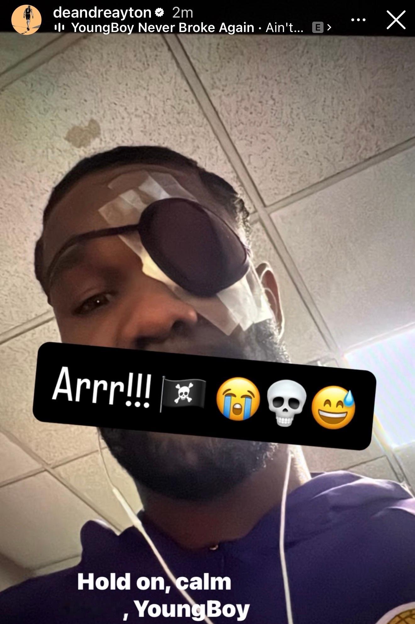 你还好吗😭艾顿刚刚更新社交媒体 