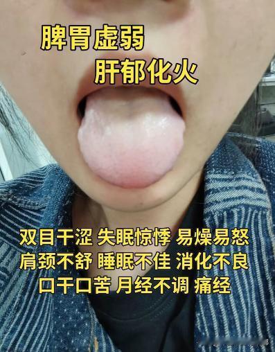 这会不忙，抽空来帮大家继续分析舌象

发的越早，越早看！小病不求人，早发现早调理