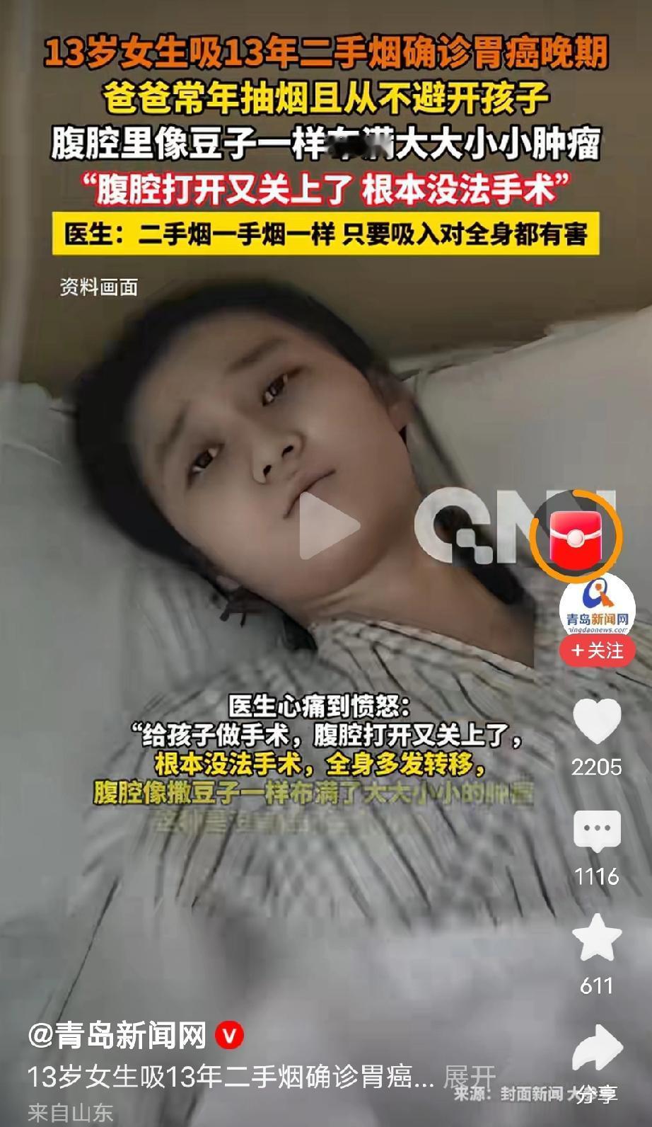 烟背不起这个锅，不要说二手烟，我们村有一个老头九十多了，还在抽旱烟，这玩意比纸烟