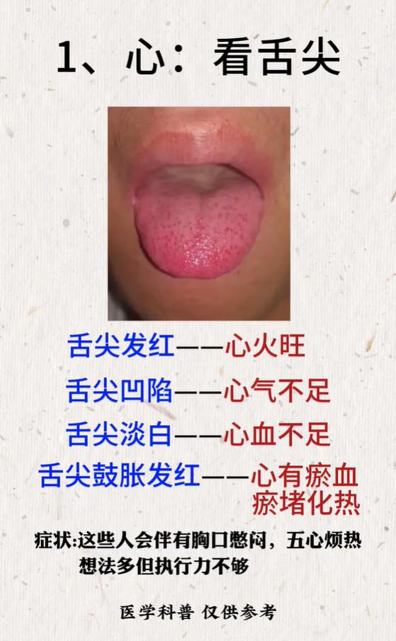 舌诊分部位，看舌尖舌根知健康
